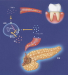 お口の細菌が糖尿病に関係